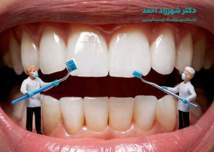 معایب انجام دادن کامپوزیت دندان چیست؟