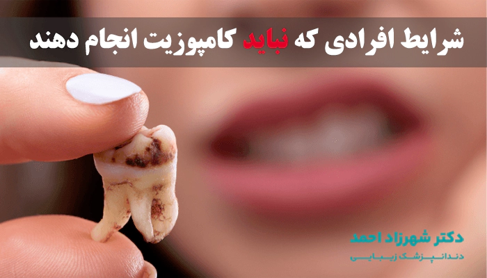 چه افرادی نباید کامپوزیت دندان انجام دهند؟