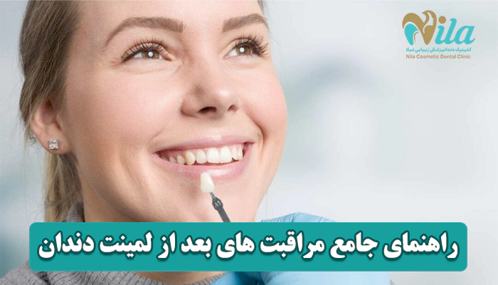 راهنمای جامع مراقبت های بعد از لمینت دندان