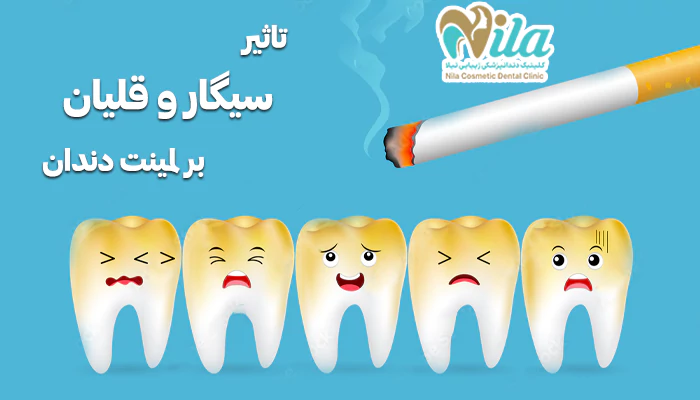 سیگار و قلیان چه تاثیری بر لمینت دندان دارند؟
