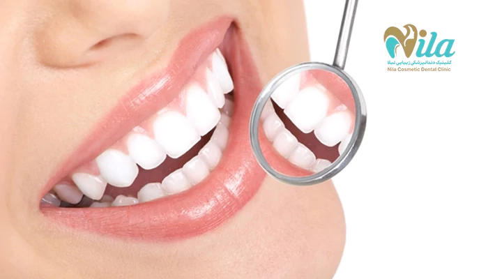بلیچینگ چند درجه دندان را روشن میکند؟