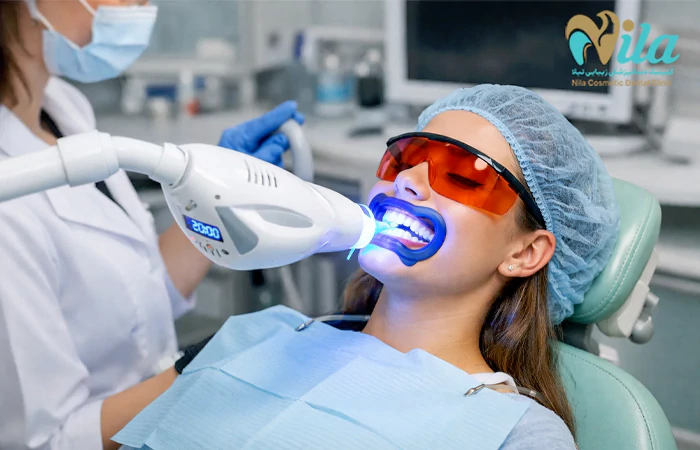 قبل از بلیچینگ کردن دندان باید چه کار کنیم؟
