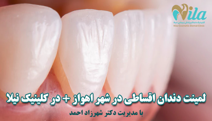لمینت قسطی در اهواز