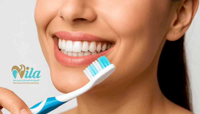 چه کسانی میتوانند بلیچینگ انجام دهند؟